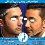 بهترین جراح بینی در تهران